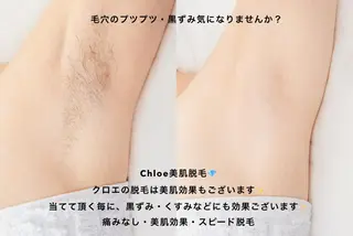 ミディアム カラー パーマ ヘアアレンジ メンズ キッズ ネイル マツエク・マツパ Chloe-クロエ- 脱毛/フェイシャルのエステ・リラクイメージ