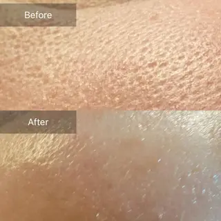 Mandarin Orange所属・毛穴から始める肌メン テマンダリンオレンジのエステ・リラクイメージ