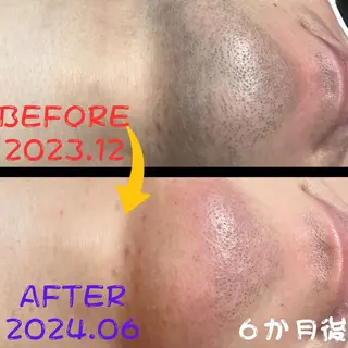 メンズ キッズ メンズ脱毛　FELISSE【フェリッセ】所属・メンズ脱毛フェリッセ /男女🆗キッズ🆗のエステ・リラクイメージ