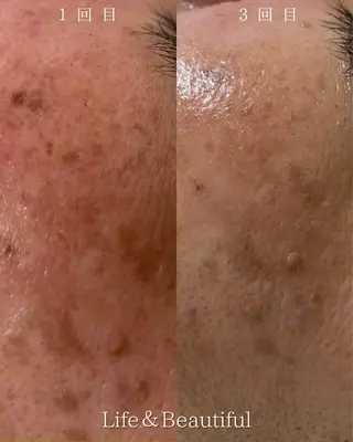 Life＆ Beautifulのエステ・リラクイメージ