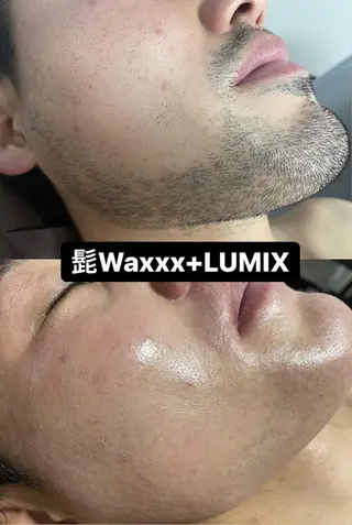 メンズ キッズ Epina 千葉店 【エピナ】のエステ・リラクイメージ