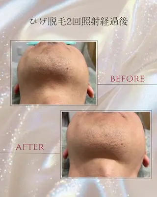 DISINI  SPA所属・DISINISPA 脱毛/フェイシャルのエステ・リラクイメージ