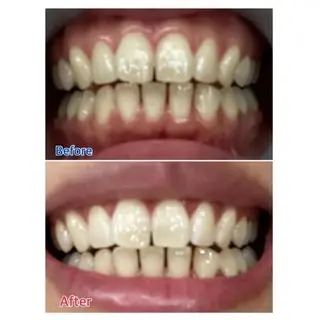 M渋谷店所属・Ｍ渋谷 ホワイトニングのエステ・リラクイメージ