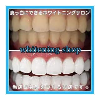 ホワイトニング ショップ浦和店のエステ・リラクイメージ