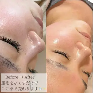 Erika komorebi_のエステ・リラクイメージ