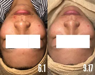 a room salonのエステ・リラクイメージ