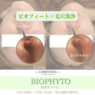 Hu.ruana AWANOのエステ・リラクイメージ