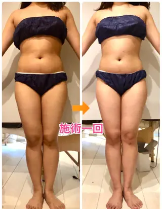 ロング カラー パーマ ヘアアレンジ メンズ キッズ ネイル マツエク・マツパ ‍痩身＆ボディ 結果出し🌟丹野のエステ・リラクイメージ