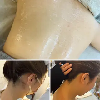 うなじ脱毛/美肌脱毛 LABELのエステ・リラクイメージ