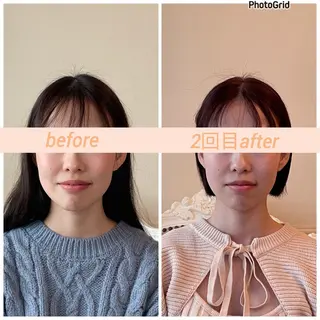 小顔矯正サロン　ReFace Fusae（リフェイスフサエ）所属・小顔矯正サロン リフェイスフサエのエステ・リラクイメージ