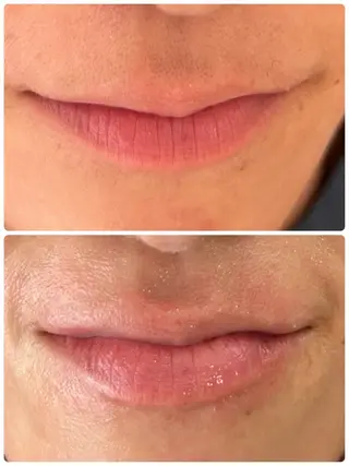 艶肌/角質ケア フェイシャルワックスのエステ・リラクイメージ