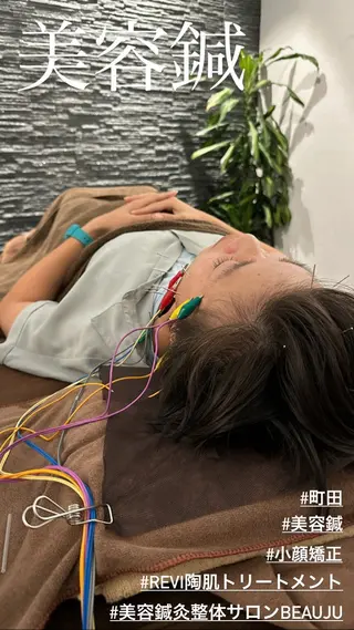 美容鍼灸整体サロンBeauJu所属・小顔矯/美容鍼/鍼灸 BeauJuのその他イメージ