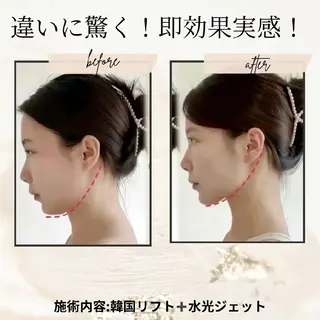 マツエク・マツパ aliaハイフ&水光ジェットサロン所属・aliaハーブ水光店 エステティシャン募集のエステ・リラクイメージ