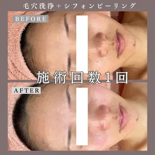 肌質改善専門サロン Bellmi/心斎橋のエステ・リラクイメージ