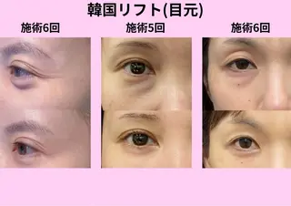 マツエク・マツパ aliaハイフ&水光ジェットサロン所属・aliaハーブ水光店 エステティシャン募集のエステ・リラクイメージ