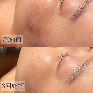 宮本 瞳のエステ・リラクイメージ