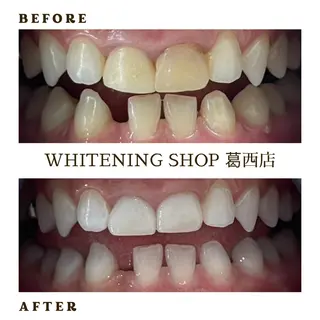 メンズ ホワイトニング ショップ葛西店のその他イメージ