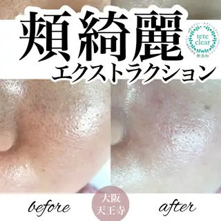 【しみ毛穴専門店】beautysalon Ankh所属・しみ毛穴専門店 Ankh 平田のエステ・リラクイメージ