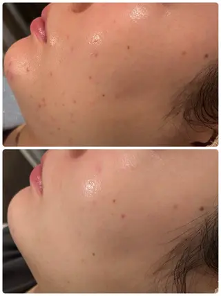 【リベルハーブピーリング認定店】敏感肌・美白脱毛専門店Dione立川店所属・Dione 立川店のエステ・リラクイメージ