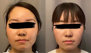 医療提携×美容整体 小顔ハイフピーリングのエステ・リラクイメージ