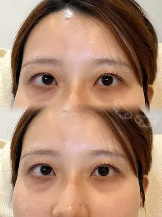 マツエク・マツパ nicott. renaのマツエク・マツパデザイン