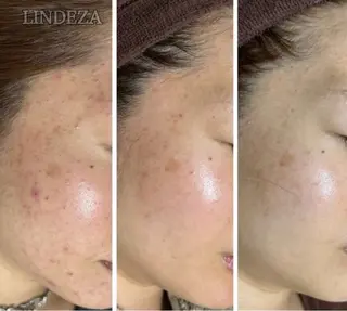 private salon 𝐋𝐈𝐍𝐃𝐄𝐙𝐀所属・LINDEZA Ayaのエステ・リラクイメージ