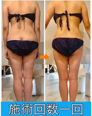 ロング カラー パーマ ヘアアレンジ メンズ キッズ ネイル マツエク・マツパ ‍痩身＆ボディ 結果出し🌟丹野のエステ・リラクイメージ