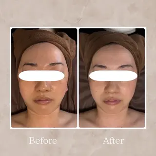 Total Beauty Salon Vi's CLUB by BINEL所属・Vi's CLUB KOTONOのエステ・リラクイメージ