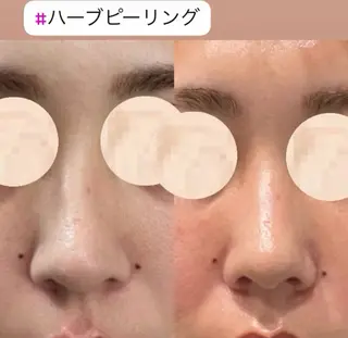 EstheticSalonReTweet所属・竹谷 春希のエステ・リラクイメージ