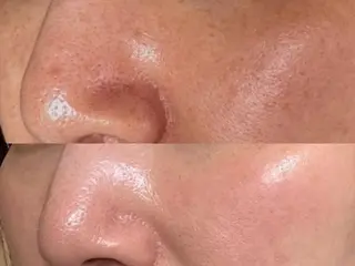 べアール所属・小顔/毛穴/ニキビ salon bealのエステ・リラクイメージ