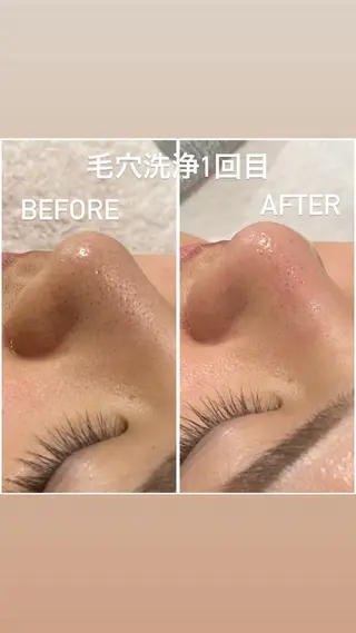 毛穴洗浄・痩身・脱毛 /アルカンジュのエステ・リラクイメージ