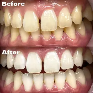 LBSホワイトニング 銀座店💎公式のその他イメージ