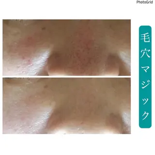 プチアンジェ所属・艶肌&小顔リフト❤︎ プチアンジェ茅ヶ崎のエステ・リラクイメージ