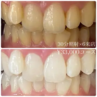 メンズ ホワイトニングルーム　川崎店所属・ホワイトニング ルーム　川崎店のその他イメージ