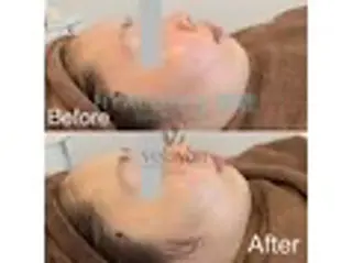 ワイズ　デュー所属・成島 雅人のエステ・リラクイメージ