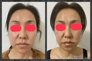 杉原 里奈のエステ・リラクイメージ