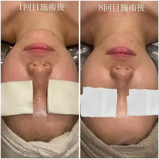 中尾 朱里のエステ・リラクイメージ