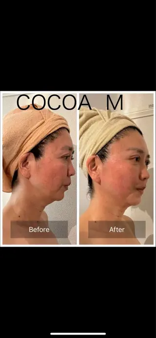 よもぎ蒸しCOCOA M（ココアエム）のその他イメージ