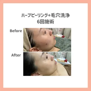 ハーブピーリング専門 muro.のエステ・リラクイメージ