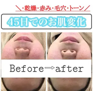 ショート カラー パーマ ヘアアレンジ メンズ キッズ ネイル マツエク・マツパ ニキビ&跡改善サロン オーナー光木のエステ・リラクイメージ