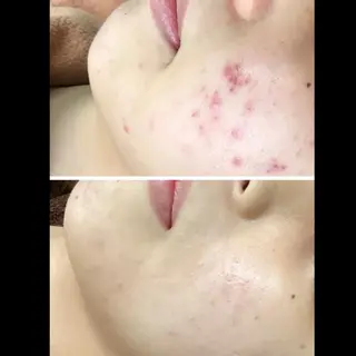 NON-NONプラス 大人の本気痩身のエステ・リラクイメージ