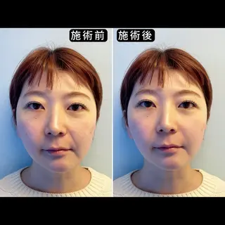 渋谷 小顔美容鍼 専門サロン YZのエステ・リラクイメージ