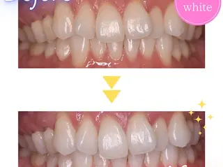 セルフホワイトニング エクシア浜松店のエステ・リラクイメージ