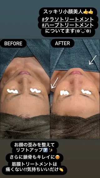 LiZA エステティックサロンのエステ・リラクイメージ