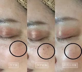 LUMY GRATiAEのエステ・リラクイメージ