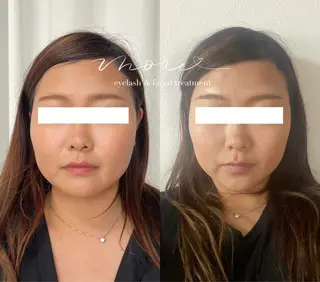 Eyelash salon MORE(モア)所属・安納 麻穂のエステ・リラクイメージ