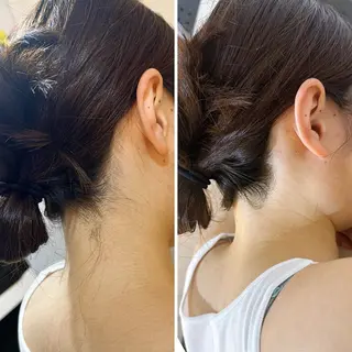 うなじ脱毛/美肌脱毛 LABELのエステ・リラクイメージ