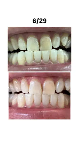 セルフホワイトニングサロンエクシアホワイト倉敷店所属・ecxiawhite 倉敷店のエステ・リラクイメージ