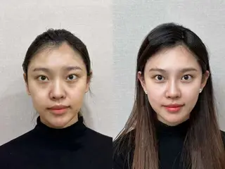 ネイル aliaハイフ&水光ジェットサロン所属・aliaハーブ水光店 エステティシャン募集のエステ・リラクイメージ