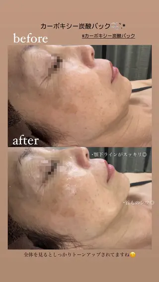 BIREINA Eyelash  Salon所属・BIREINA 住之江公園のマツエク・マツパデザイン